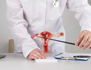 medical agency in czech republic endometriosis surgery